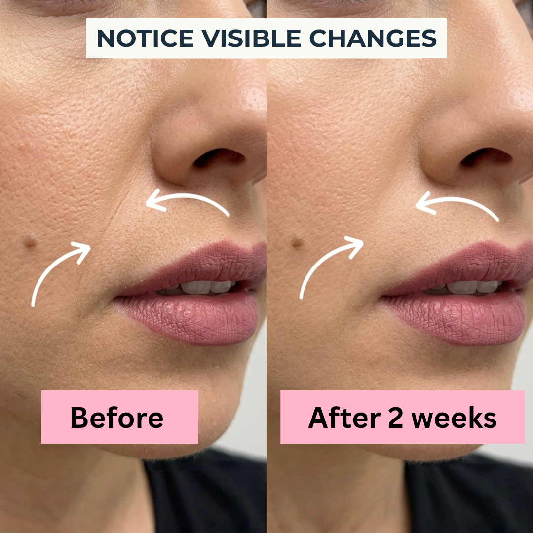 LeoFind Virela™ Defined Lift Essence